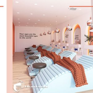 کاشت مژه مژگون